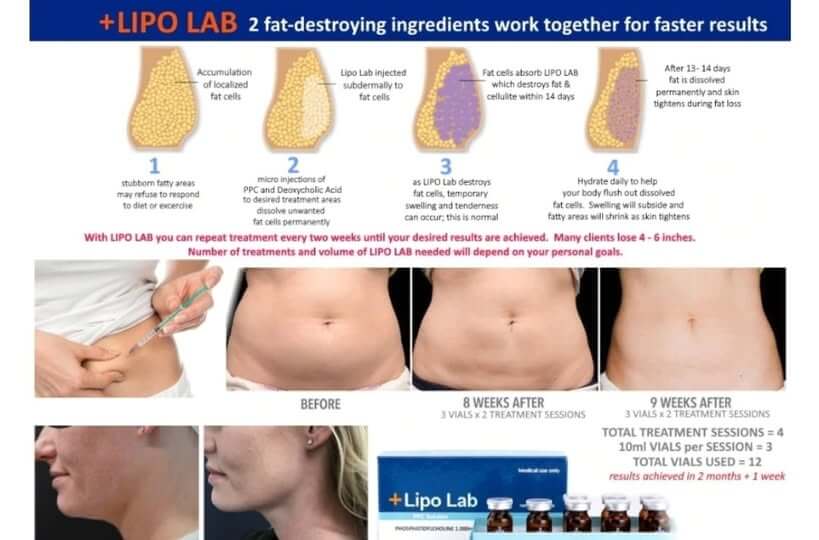 Infographic displaying Lipo Lab fat-destroying process results: before and after treatment, showcasing effectiveness in body areas.